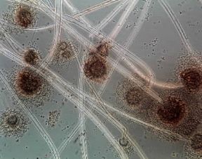 Fungo. Esemplare di Aspergillus niger in una microfotografia.De Agostini Picture Library/E. Giovenzana