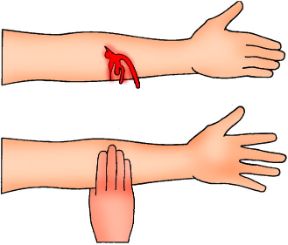 Intervento su emorragia esterna. Emorragie esterne. In caso di ferita ampia accostate i margini e teneteli uniti premendo saldamente con la punta delle dita.
