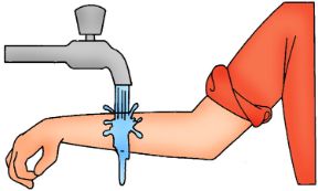 Ferita semplice: lavare la ferita. Ferita. In caso di escoriazioni o ferite semplici è consigliabile pulire e lavare la parte lesa, aiutandosi con una garza sterile, dopo aver disinfettato accuratamente le mani.