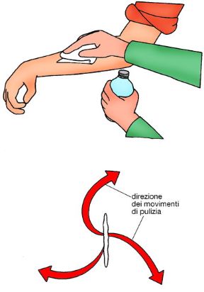 Ferita semplice: disinfezione della ferita. Ferite semplici ed escoriazioni. Prima di usare il disinfettante, procedere alla pulizia della ferita.