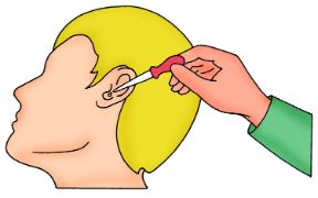 Corpo estraneo nell'orecchio: rimozione di un insetto. Corpi estranei nell'orecchio. Se è un insetto a essere entrato nell'orecchio potete affogarlo con una goccia d’olio.