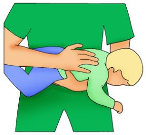Primo soccorso per neonati. Liberazione delle vie respiratorie. Primo soccorso per neonati e bambini. Se un neonato rischia di soffocare sostenetelo con un avambraccio e dategli delle piccole pacche tra le scapole.