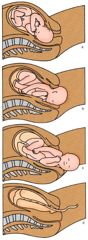 Le fasi del parto. Parto. a: dilatazione del canale del parto; b: impegno della testa nel canale del parto; c: dopo la testa passano, una alla volta, le spalle; d: espulsione della placenta e degli annessi. 