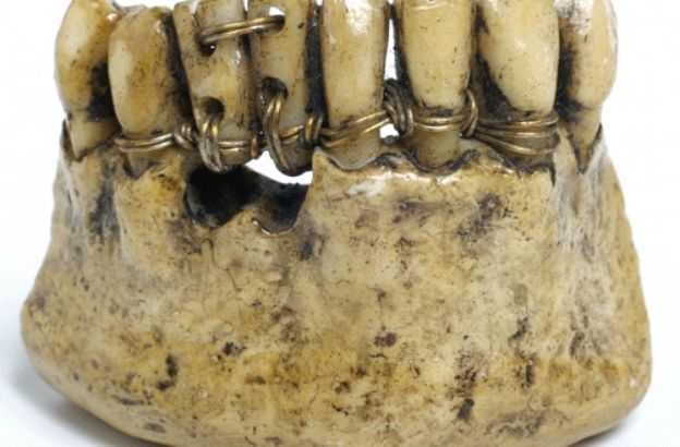 denti-etruschi