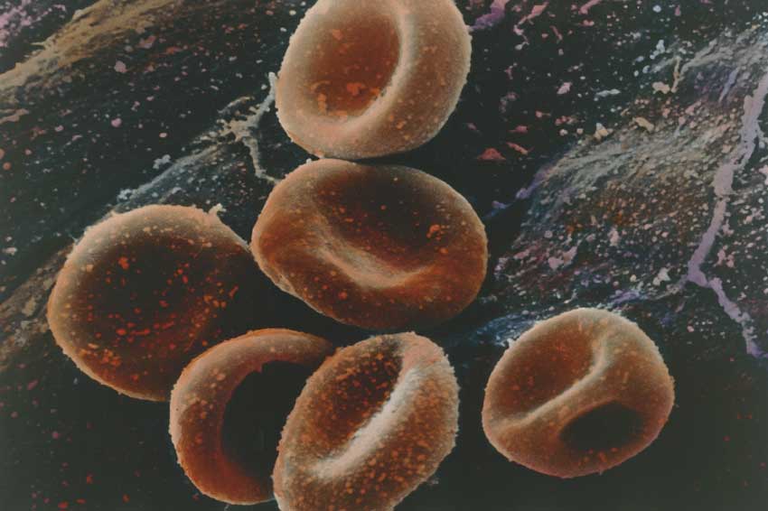 Globuli rossi Globuli rossi sull'endocardio al microscopio.
© De Agostini Picture Library