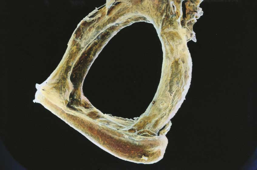 Staffa dell'orecchio Staffa dell'orecchio al microscopio.
© De Agostini Picture Library