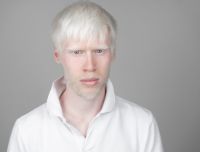 Albinismo e superstizione nel mondo
