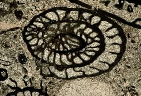 Foraminiferi al microscopio.De Agostini Picture Library