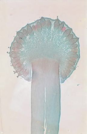 AscomicÃ¨ti. Sferidio di Claviceps purpurea visto al microscopio.De Agostini Picture Library/Archivio B