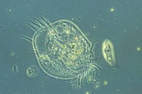 Protozoi. Un ciliato appartenente al genere Euplotes.De Agostini Picture Library