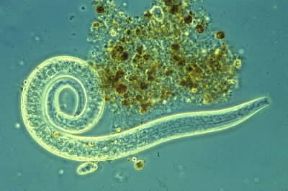 Nematodi . Microscopico nematodo di acque interstiziali salmastre.De Agostini Picture Library / S. Giacomelli