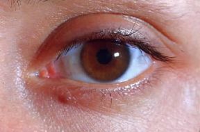 Iride . Occhio umano con iride bruna.De Agostini Picture Library/P. Castano