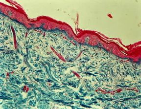 Cute. Sezione al microscopio di cute; Ã¨ visibile lo strato di sebo (rosso scuro) che ricopre l'epitelio connettivo.De Agostini Picture Library / E. Giovenzana