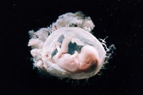 Amnio. Embrione umano, dentro il sacco amniotico, alla nona settimana di vita intrauterina.De Agostini Picture Library/L: Ricciarini