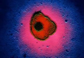A.I.D.S. Ingrandimento al microscopio di un citomegalovirus presente nella patologia dell'A.I.D.S.Farabolafoto