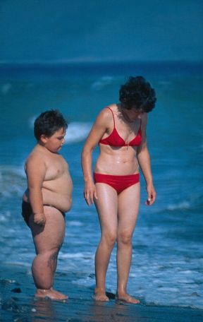 Accumulo di sostanze grasse nell'organismo. Adipe. Nell'uomo l'accumulo di sostanze grasse nei tessuti è variabile e legato a diversi fattori quali l'età, il sesso, la razza, il tipo di alimentazione, l'ereditarietà.