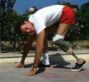 L'arto artificiale. Invalidità. Molte possono essere le cause di invalidità. Oltre alla presenza di handicap congeniti, ci si può trovare con una memomazione che si instaura nel corso della vita: come nel caso qui raffigurato che mostra una protesi, un arto artificiale, inserita dopo l'amputazione della gamba.