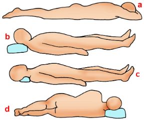Le corrette posizioni durante il sonno. Sonno. La posizione che assumiamo durante il sonno è assai importante. Dormire sul ventre può provocare mal di testa e di schiena (a); un cuscino troppo alto rischia di affaticare collo e spalle (b); quando si dorme supini, un piccolo cuscino sotto al collo può favorire una corretta posizione della colonna vertebrale (c); un cuscino può aiutare a mantenere il naturale allineamento della colonna quando si dorme su un fianco (d).