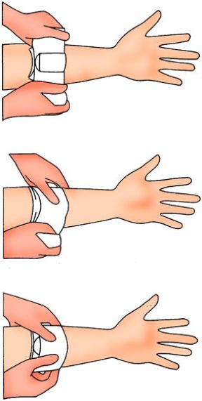 Intervento in caso di emorragia. Compressione con un tampone. Emorragia. In caso di fuoriusciuta di sangue arterioso o venoso da lesioni, bisogna cercare di controllare la perdita ematica comprimendo la ferita con un tampone, una garza ben aderente o un fazzoletto.