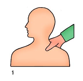 La compressione arteriosa. Caso di ferita alla spalla. La compressione arteriosa. In caso di ferita alla spalla o di strappo al braccio si comprime dietro la clavicola con il pollice.