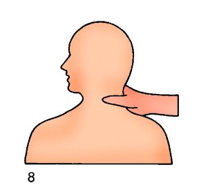 La compressione arteriosa. Caso di ferita al collo. La compressione arteriosa. In caso di ferite al collo si comprime la carotide con il pollice immediatamente sotto la ferita