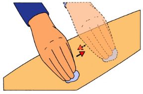 Come evitare danni da immobilizzazione: non frizionare le gambe. Rischi dell'immobilizzazione. Non frizionare mai le gambe del malato. Questa operazione potrebbe infatti favorire il distacco di un trombo formato in precedenza.